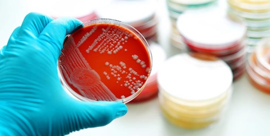 Swab on a solid culture medium