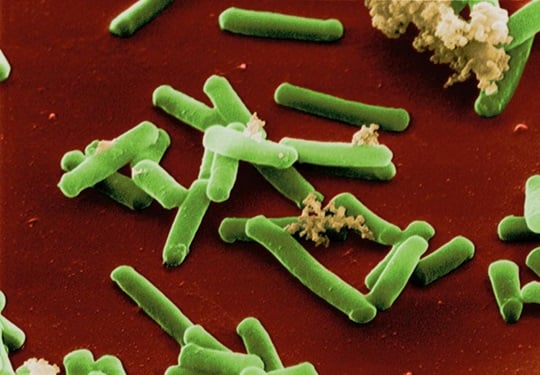 Anaerobe / anaerobic