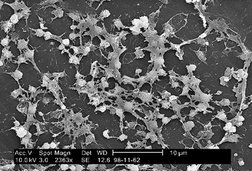 Biofilm