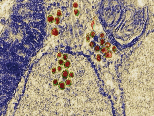 BVD virus