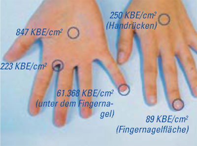 Concentration of microorganisms