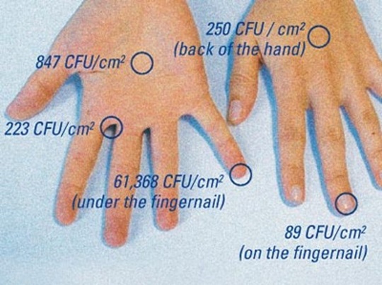 Concentration of microorganisms