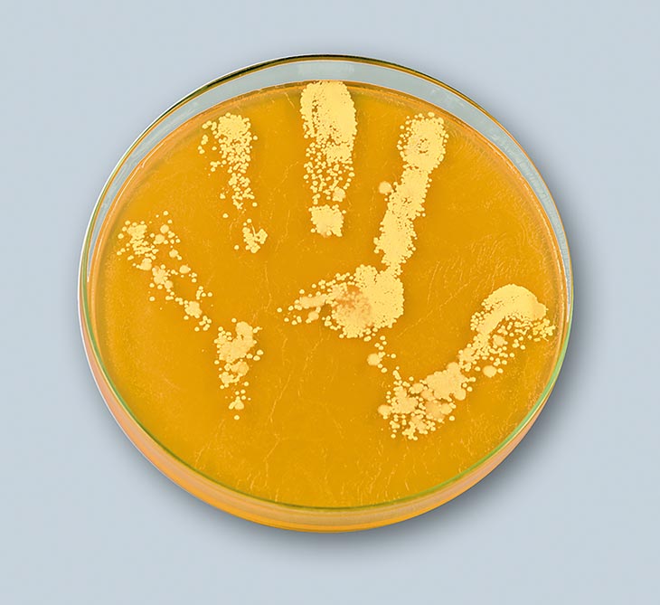 Contact-plate sampling