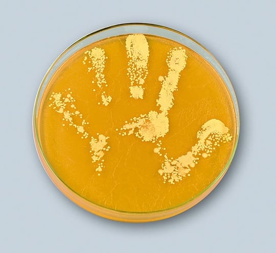 Contact-plate sampling