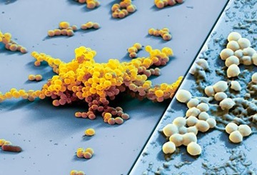 Disinfektion