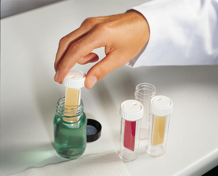 Eintauch-Nährböden