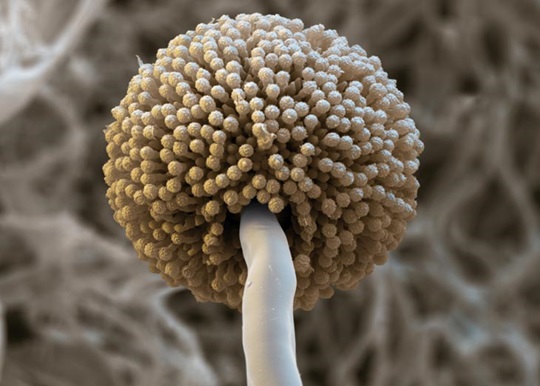 Aspergillus brasiliensis