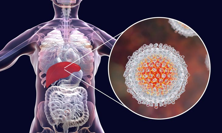 Hepatitis C virus (HCV)