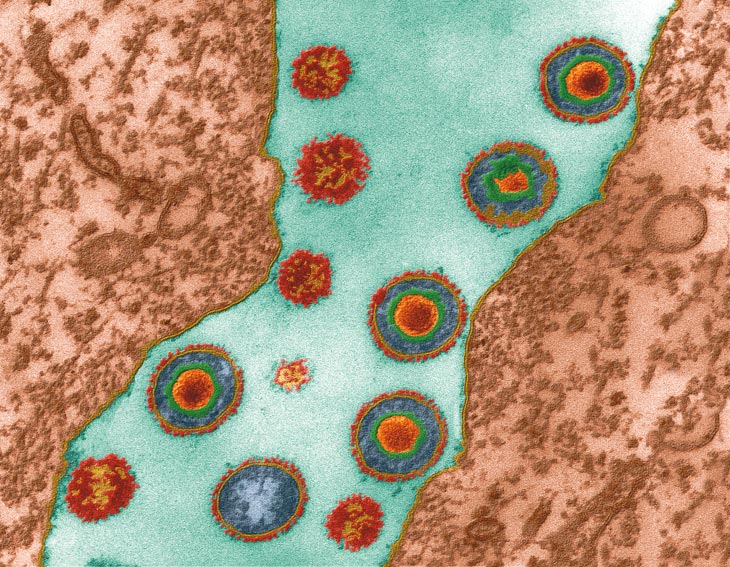 Herpes simplex virus (HSV)