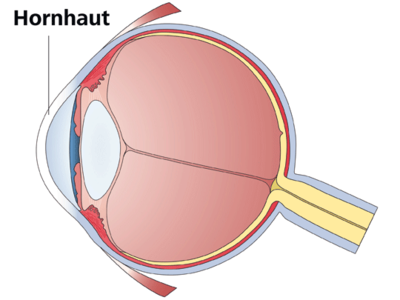 Keratoconjunctivitis epidemica