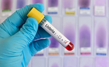 Listeria monocytogenes
