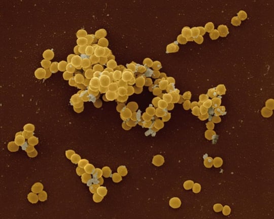 MRSA