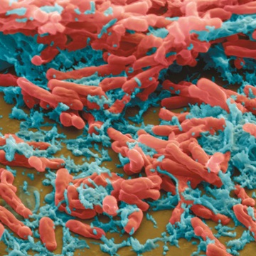 Mycobacteria