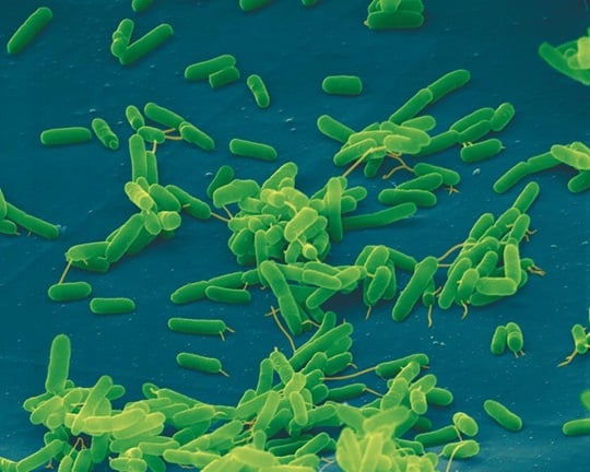 Pseudomonas aeruginosa
