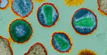 Retroviruses
