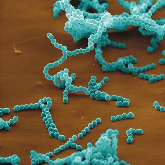 Streptococcus