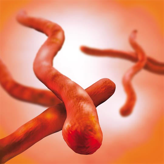 Borrelia burgdorferi