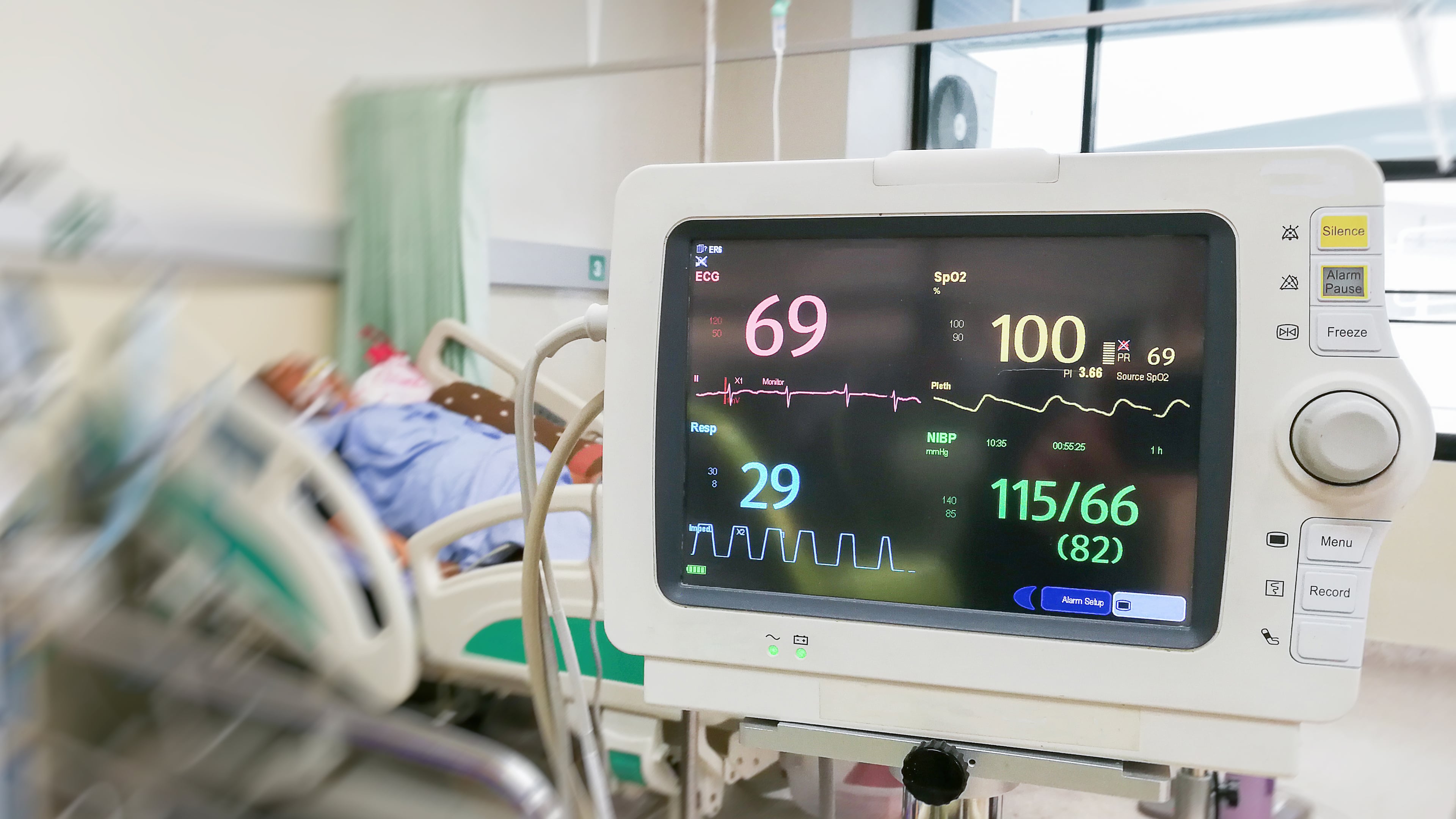 Patient monitoring device displaying vital signs beside a hospital bed in a clinical care setting.