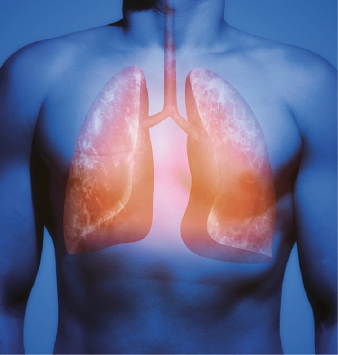 Nosokomiale Infektionen HARTMANN SCIENCE CENTER